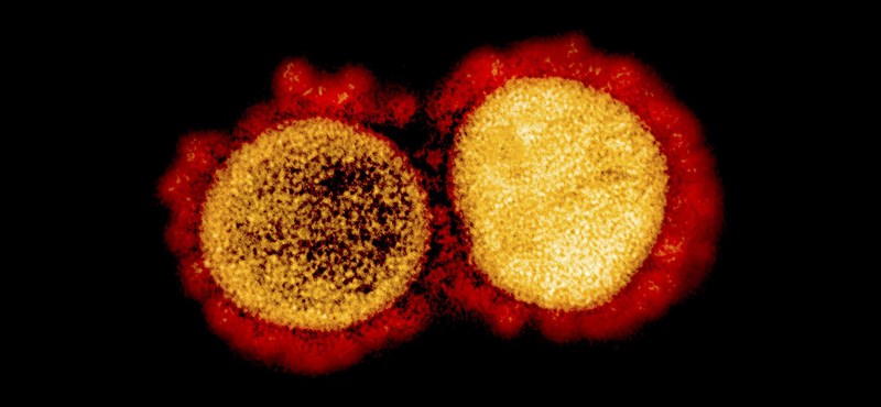 There are 93 more victims of the coronavirus epidemic in Hungary